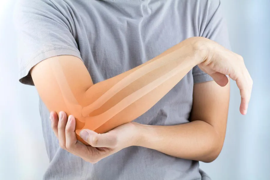 Osteoporosis-Doctor A close-up of a woman holding her elbow with an illustration of the bones and joint experiencing pain from osteoporosis. Get osteoporosis treatment from Delara Tavakoli, M.D. of Tavicare in Chevy Chase.